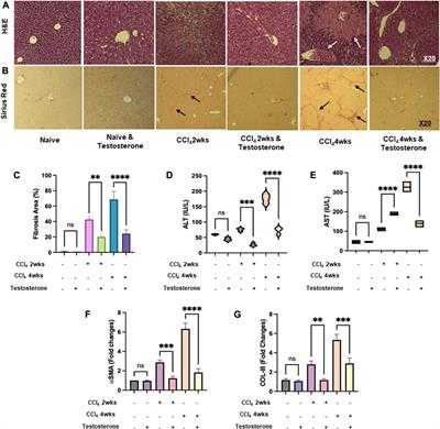 The immune and metabolic treatment approach of using testosterone on mice models of liver injury